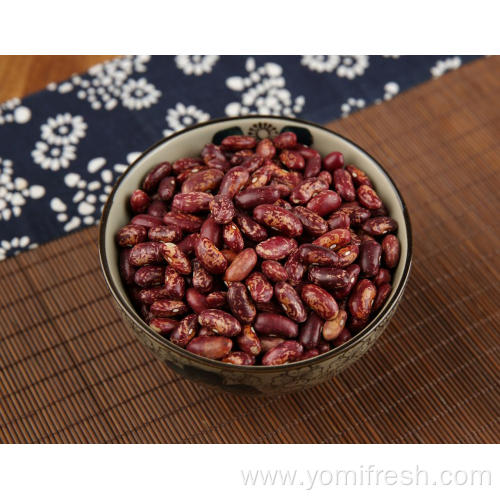 Kidney Beans Good For Kidneys